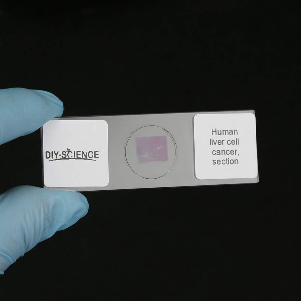 Prepared Human Pathology Microscope Slide Set, 12pcs Research-Quality Prepared Tissue Microscope Slides of Human Diseases (Human Pathology)
