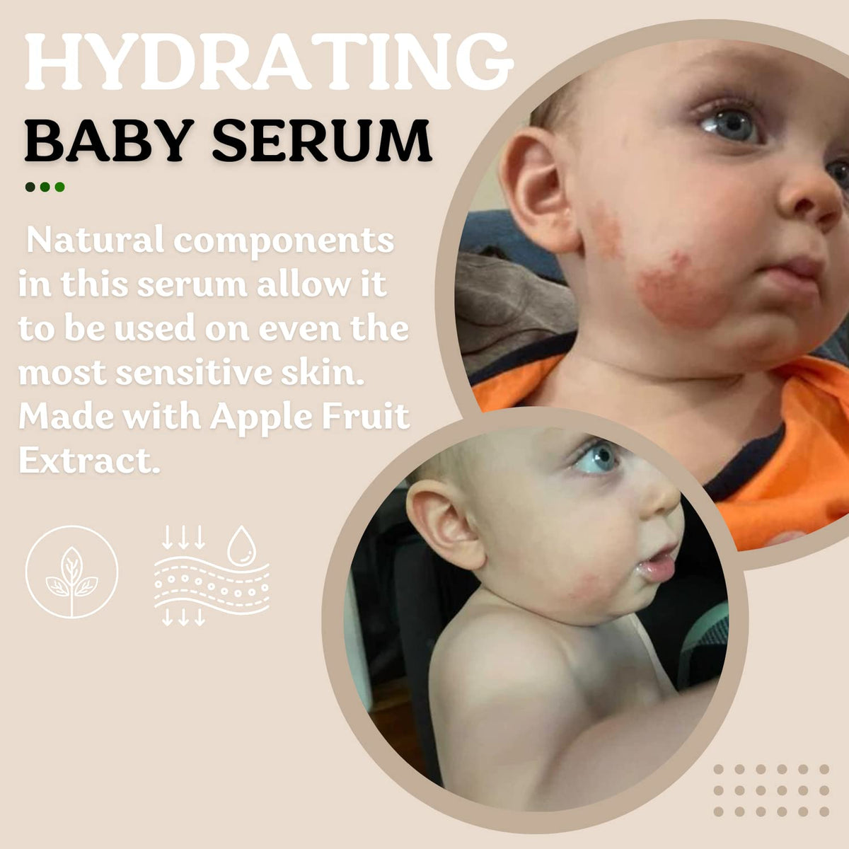 Roe Wellness- Baby Serum Hydrating Skincare Probiotic Protection | Hydrate, Soothe, Clean Ingredients & Safe For All Skin Babies, Infants, Toddlers & Kids (Power Serum)