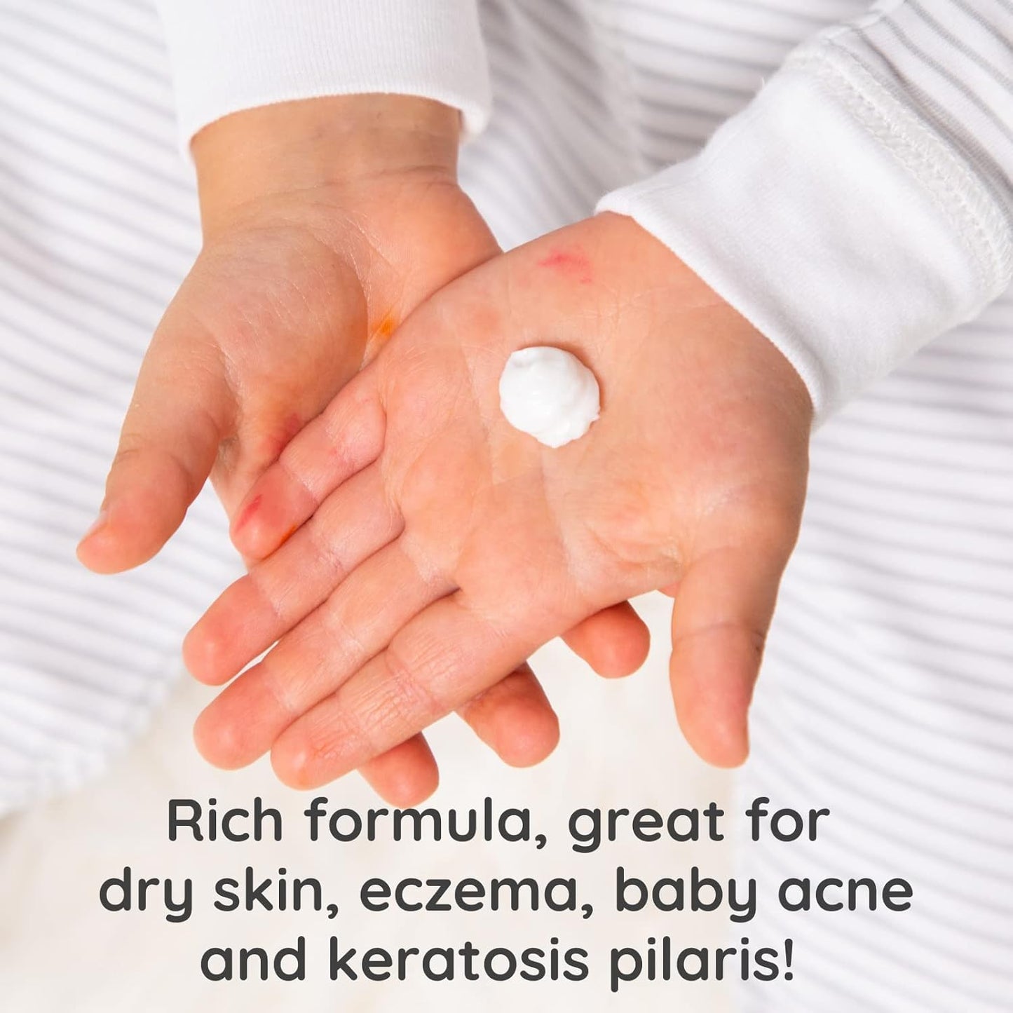 Bubbsi Whipped Coconut Oil Baby Lotion for Eczema, Dry Skin, Baby Acne, KP | Organic Coconut Oil, Shea Butter, Vitamin E | Light, Natural Scent | EU Compliant, Vegan (Refill Pouch, 32oz)