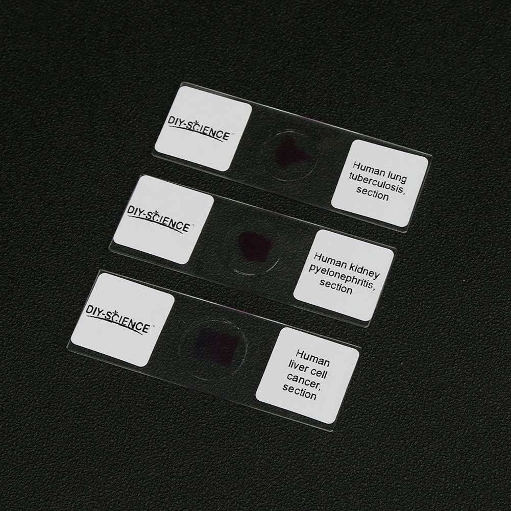 Prepared Human Pathology Microscope Slide Set, 12pcs Research-Quality Prepared Tissue Microscope Slides of Human Diseases (Human Pathology)